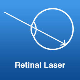 retinal-laser